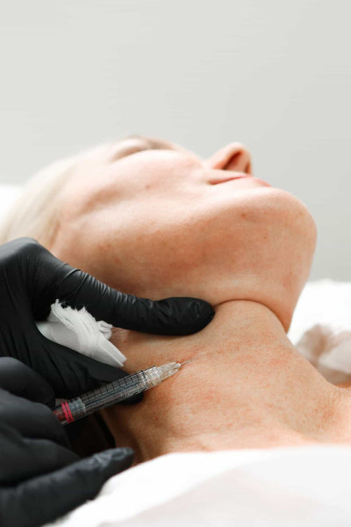 What filler is in a 5 point facelift?