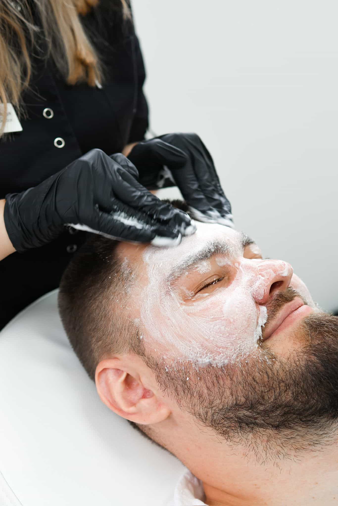 Obagi Blue Peel Radiance Peel for Skin Remodeling in Kingston Upon Thames Surrey London